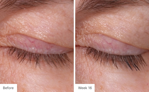 Close-up image of eyelashes showing fuller and longer lashes after 16 weeks of Lash Lush use